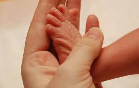 Cara Mengatasi Kulit Kering Dan Bersisik Pada Anak